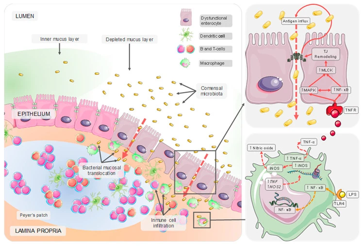Dysfunctional Intestinal Mucosal